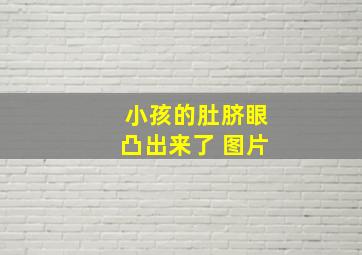 小孩的肚脐眼凸出来了 图片